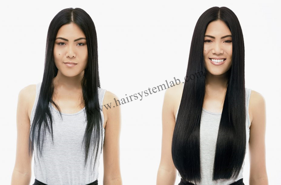 Non Surgical Hair Replacement, Hair Patch, Hair Wigs, Fix Hair Wigs, Men  Hair Wigs, Female Hair Wigs, Hair Extensions, Hair Fixing, Hair Patch Clip  System, Hair Replacement, Shop, Services, Provider, service provider